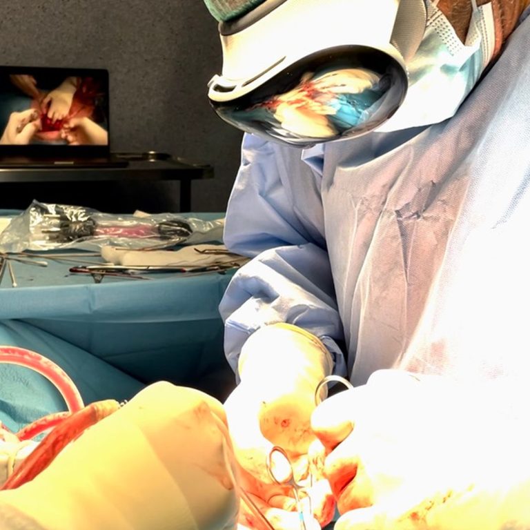 surgeryAppleVisionPro
